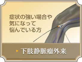 症状の強い場合や気になって悩んでいる方 下肢静脈瘤外来